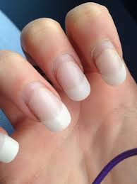 The lifting can be removed and the exposed natural nail will be covered with fresh acrylics. How Much Are Fillings For Nails Nailstip