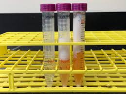 8 Enzymes Laboratory Manual For Sci103 Biology I At Roxbury Community College