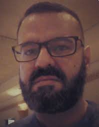 Pais optam por uma cirurgia na filha para remover uma marca de nascença  rara: “as pessoas olhavam para ela”