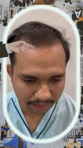 ការផ្ដល់ជូនប្រ៉ូម៉ូសិនពិសេសទៀតហើយបងបង 👏👏👏,  សំរាបអតិថិជនដាំសក់នៅក្នុងខែនេះ📣ដាំកាន់តែច្រើនតំលៃកាន់តែពិសេសនិងបានការថែមជូនកាន់តែច្រើន,  📍ទីតាំងក្រោយផ្សារទួលគោក , ⏰ម៉ោងធ្វើការ បើក9ព្រឹក បិទ6ល្ងាច, ...