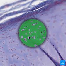 It rests inferior to the thyroid cartilage. Hyaline Cartilage Histological Features And Cells Kenhub