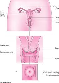 The same sample can be checked for abnormal cells (a pap test). Cervical Ectropion Cervical Erosion Information
