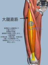大腿 直 筋 痛み