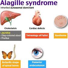 Alagille Syndrome Pediatric Boards Peds Medical