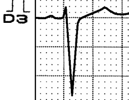 Camels' humps consist of stored fat, which they can metabolize when food and water is scarce. Http Cardiolatina Com Wp Content Uploads 2019 04 Andres Pdf