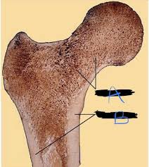 Some descriptions for confusing partsomit number 13 in the picture. Structure Of Compact Bone Labeled Quizlet