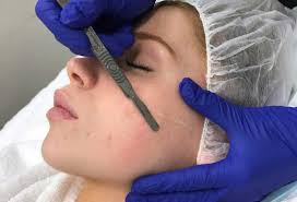 Ivory aesthetics clinic is your skin's best friend! Dermaplaning It S More Than Just Shaving Your Face Ivory Aesthetics Clinic