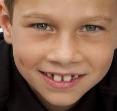 UNDERSTANDING TEACHERS' PERSPECTIVES ON