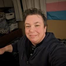 What are the experiences with top surgery at Swedish Hospital or University  of Washington Medical Center in Seattle?