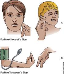 Check out the pronunciation, synonyms and grammar. Trousseau Sign Of Latent Tetany Is A Medical Sign Observed In Patients With Low Calcium This Sig Nursing Pneumonics Nursing School Survival Hypoparathyroidism