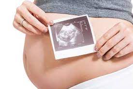 Amdal tunggal adalah hanya satu jenis usaha dan/atau kegiatan yang kewenangan pembinaannya di bawah satu instansi yang membidangi usaha dan/atau kegiatan. Maserasi Untuk Memperkirakan Waktu Kematian Bayi Di Dalam Kandungan Alodokter