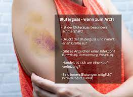 Der bluterguss verschwindet sehr schnell. Wann Sollte Man Mit Einem Bluterguss Zum Arzt