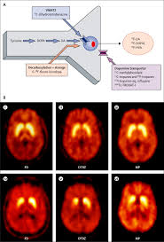 Supplemental Materials For Imaging Insights Into Basal Ganglia Function Parkinson S Disease And Dystonia The Lancet