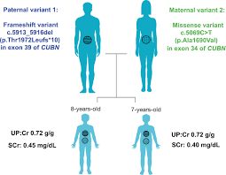 Image result for Isolated Proteinuria