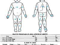 Burns Children And Infants Lund Browder Chart Lund Chart