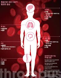 얀센 백신은 한국 정부가 올 2분기 중 600만명분 물량을 공급받기로 한 백신이다. ê³µí¬ì˜ í˜ˆì „ì¦ ì œëŒ€ë¡œ ì•Œì•„ì•¼ ëŒ€ì²˜ ê°€ëŠ¥í•˜ë‹¤ ì‹œì‚¬ì €ë„