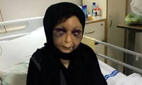 Attacked woman to be moved to Dar Al Aman