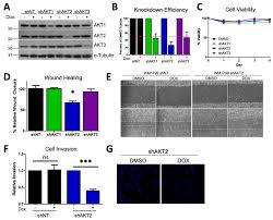 AKT2 depletion impairs migration and invasion in WM1799 human melanoma... |  Download Scientific Diagram