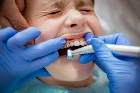 Your dentist will place the temporary filling and inform you not to put too much force on it. No More Drilling Contactless Cavity Filling With Er Yag Laser