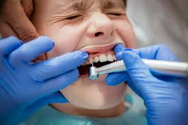 You should floss once each day and brush your teeth twice each day. No More Drilling Contactless Cavity Filling With Er Yag Laser