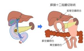 主な診断方法 治療法 手術件数 静岡がんセンター