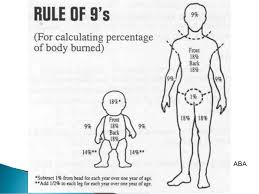 Pediatric Burns