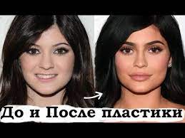 Maybe you would like to learn more about one of these? Kajli Dzhenner Do I Posle Plastiki 2020 Youtube