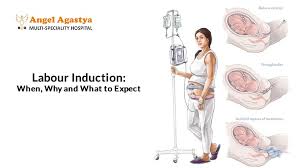 Image result for Labor Induction