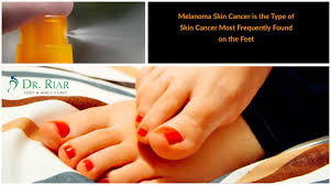 See mouth cancer pictures to learn what common mouth cancer sores on the tongue, gums, and cheek look like. Dr Jaspaul Riar On Twitter Yes Skin Cancer Can Be Found On Feet In Fact Melanoma The Most Deadly Type Of Skin Cancer Is Most Frequently Found On Feet Abnormal Freckle Or