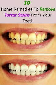 10 Home Remedies To Remove Tartar Stains From Your Teeth Teeth Care Stained Teeth Gum Disease