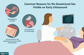 Gestational age is a measure of the age of a pregnancy which is taken from the beginning of the woman's last menstrual period (lmp), or the corresponding age of the gestation as estimated by a more accurate method if available. What No Gestational Sac On The Ultrasound Means