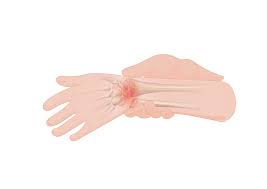 Maybe you would like to learn more about one of these? Pain Wikipedia