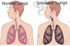 When I Am Running And Jogging Frequently, Does It Clean My Lungs As A  Smoker? - Quora