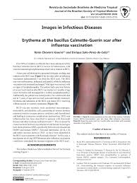They are provided by the ministry of health (moh) as part of the expanded programme of immunisation (epi). Pdf Erythema At The Bacillus Calmette Guerin Scar After Influenza Vaccination