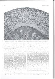 Image result for Keetia gueinzii