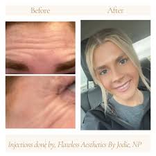 Injections By Jordan