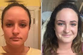 Bloom Esthetic Skin Care