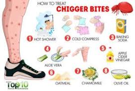 How can you tell one bit from another? Bug Bites 101 Flea Bite Vs Mosquito Bite Vs Spider Bite Vs Chigger Bite Pest Wiki