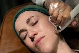 Microneedling: a guide to the skincare trend