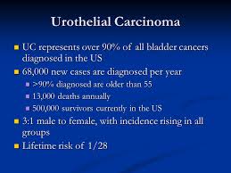 Bladder cancer is where a growth of abnormal tissue, known as a tumour, develops in the bladder lining. Non Muscle Invasive Bladder Urothelial Carcinoma Ppt Video Online Download