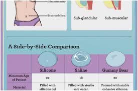 30 Explicit Saline Breast Implant Size Chart