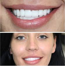 V Smile Centre in Antalya, Turkey • Read 18 Reviews