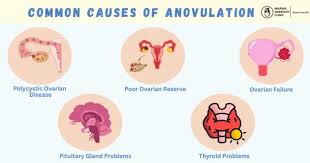 Image result for Anovulation
