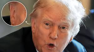 Donald Trump Seen in Public Without Ear Bandage After Assassination Attempt