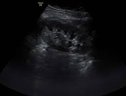 Diffuse Renal Parenchymal Diseases | Radiology Key