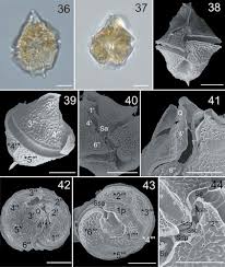 Image result for Hyperacanthus