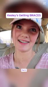 Kasey Simon Gets Braces