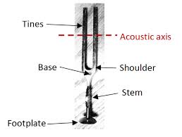 Image result for Tuning Fork Test