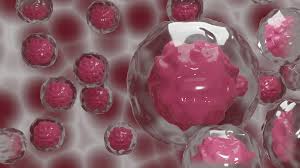 Alcohol use disorder raises your risk. World First Discovery Paves Way To New Cancer Treatment