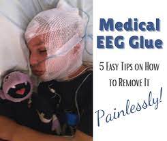 How to get medical glue out of hair. 5 No Tears Tips To Remove Medical Eeg Glue From Hair A Day In Our Shoes